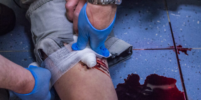 Úrazy na pracovišti: kdy nemáte nárok na odškodnění?