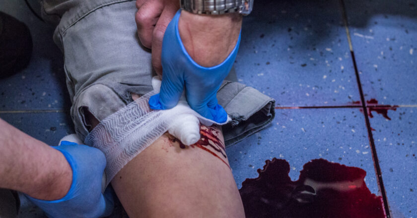 Úrazy na pracovišti: kdy nemáte nárok na odškodnění?